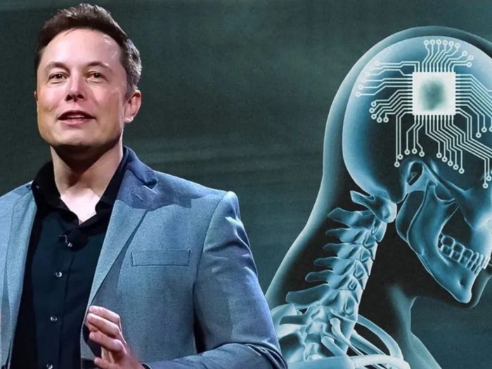 Neuralink của Elon Musk phát hiện sự cố sau ca cấy chip vào não người -  Tuổi Trẻ Online
