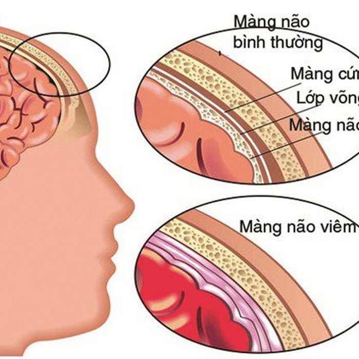 Kết quả tìm kiếm từ khóa 