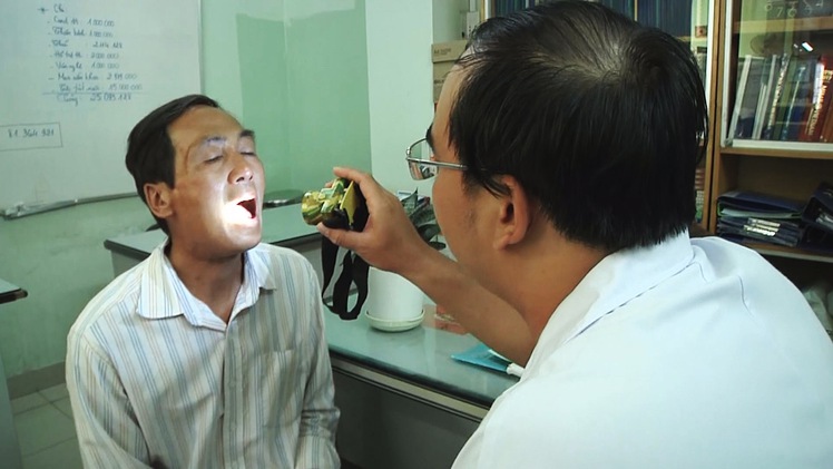 Phút cảnh báo: Cảnh giác với các dấu hiệu của ung thư lưỡi
