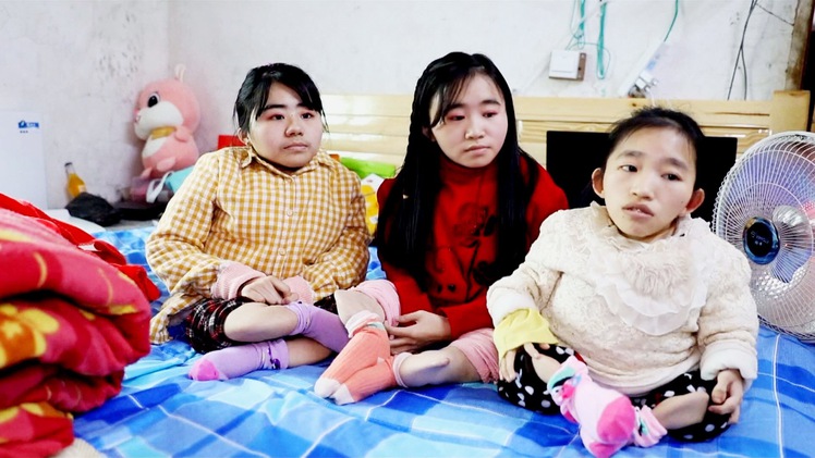 Nghị lực sống của ba chị em mắc bệnh giòn xương