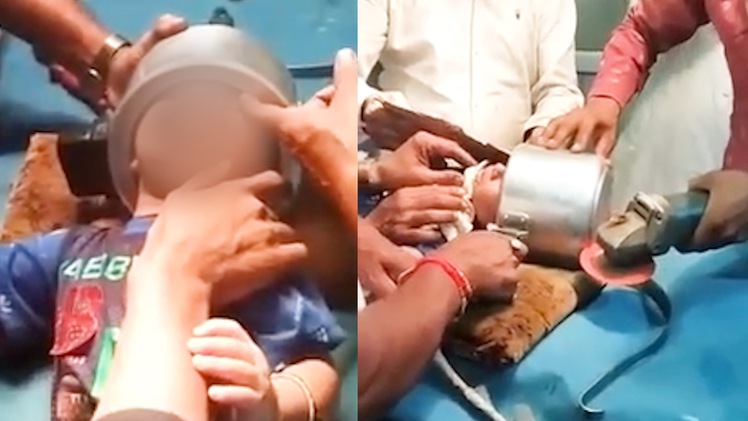 Video: Toát mồ hôi giải cứu cháu bé bị kẹt đầu vào nồi áp suất