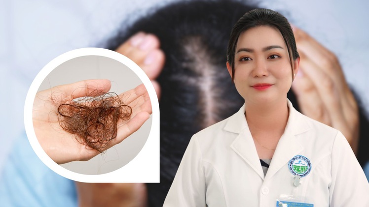 Bác sĩ tư vấn: Rụng tóc có thể để lại hậu quả nguy hiểm gì?