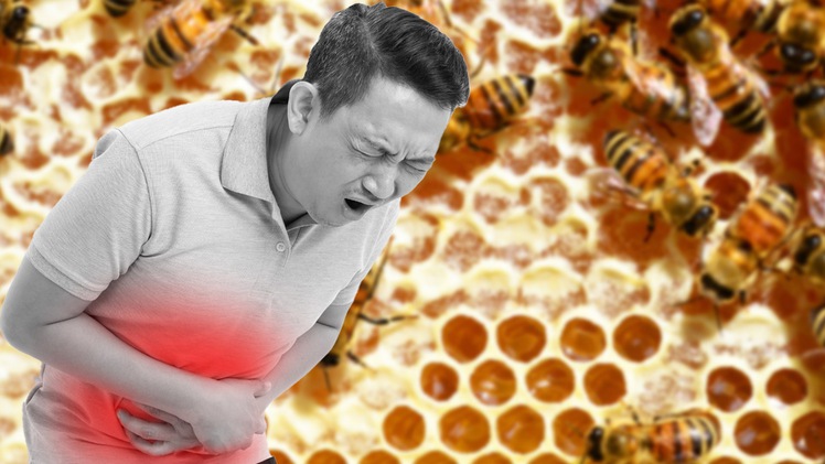Cách giảm đau dạ dày nhanh chóng với mật ong
