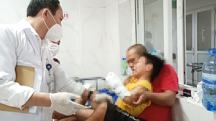Video: Cháu bé 8 tuổi mất hai bàn tay do chế tạo pháo nổ