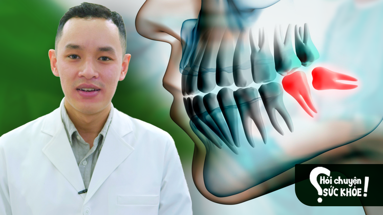 Răng khôn mọc lệch ảnh hưởng đến sức khỏe ra sao?
